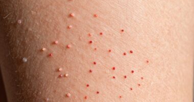 causes of strawberry skin