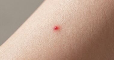 effective ingrown hair prevention