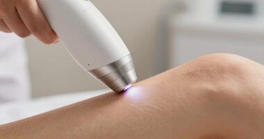 home laser hair permanence