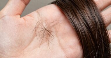 identify hair loss type