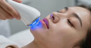 led therapy and hyperpigmentation