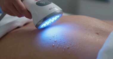 led therapy causes dryness