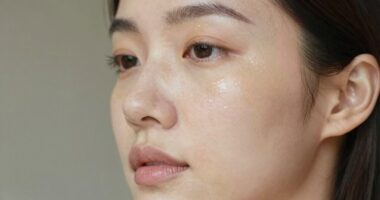 led treatment for melasma