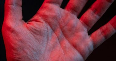 light spectrum skin response