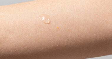 microbiome influences body odor