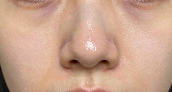 nose produces more oil