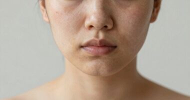 posture links to puffiness