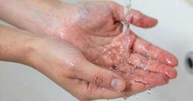 protect skin from hand washing