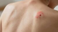 referred pain from trigger points