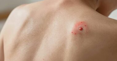 referred pain from trigger points