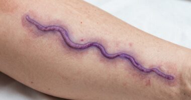 risks of massage therapy