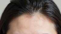 scalp care and hair growth