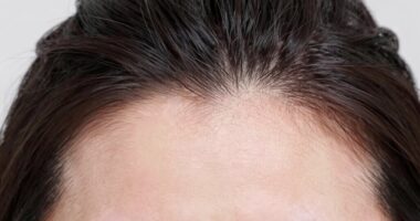 scalp skin care tips
