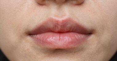 sensitive skin reacts quickly