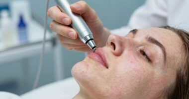 signs of sensitive skin