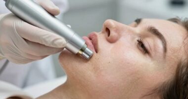 skin exfoliation and limitations