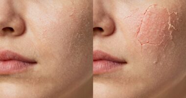 skin hydration comparison test