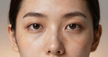skin pigmentation correction method