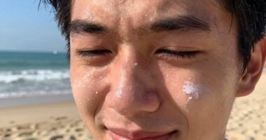 sunscreen sting causes solutions