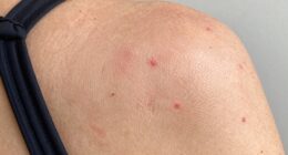 friction triggers breakouts