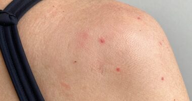 friction triggers breakouts