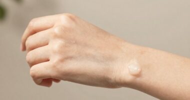 healing skin barrier stage