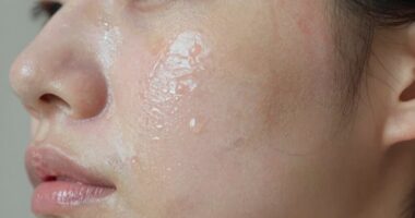 oily fragile skin paradox