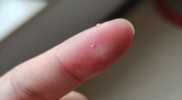 persistent mild stinging warning