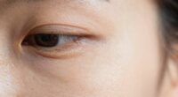 protect delicate eye skin