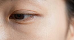 protect delicate eye skin