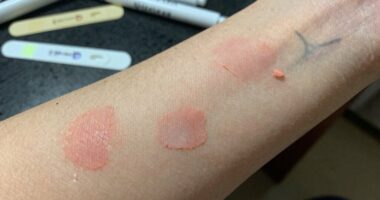 rushing causes patch test failures