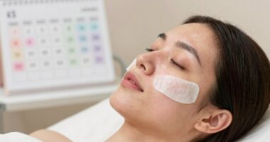 schedule microdermabrasion sessions appropriately
