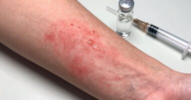 signs of worsening reaction