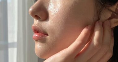 skin condition fluctuations explained