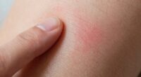 skin response mechanisms comparison