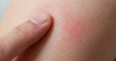 skin response mechanisms comparison