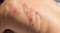 sunlight worsens ipl results