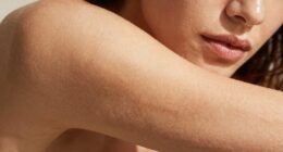 thicker less frequent exfoliation