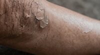 understanding rough skin textures