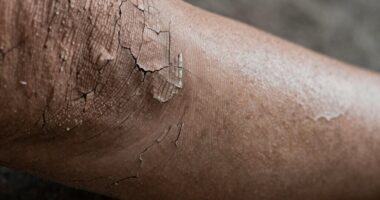 understanding rough skin textures